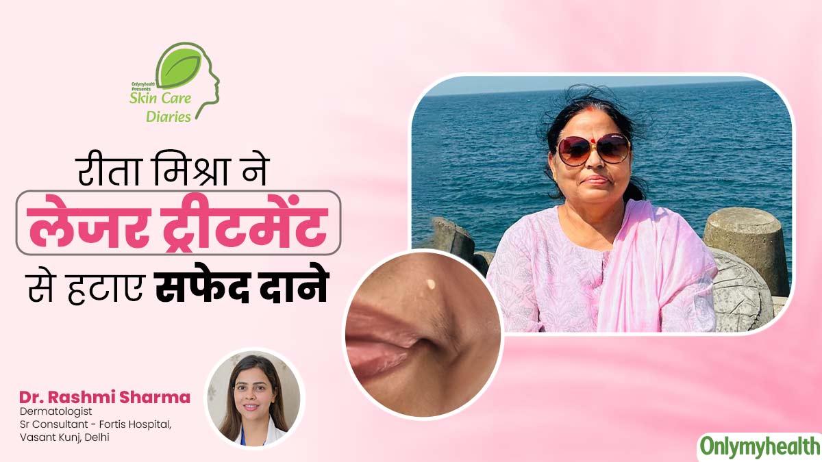 चेहरे के सफेद दाने मिटाने के लिए रीता मिश्रा ने लिया लेजर ट्रीटमेंट, जानें कितने सेशन में ठीक हुई उनकी समस्या
