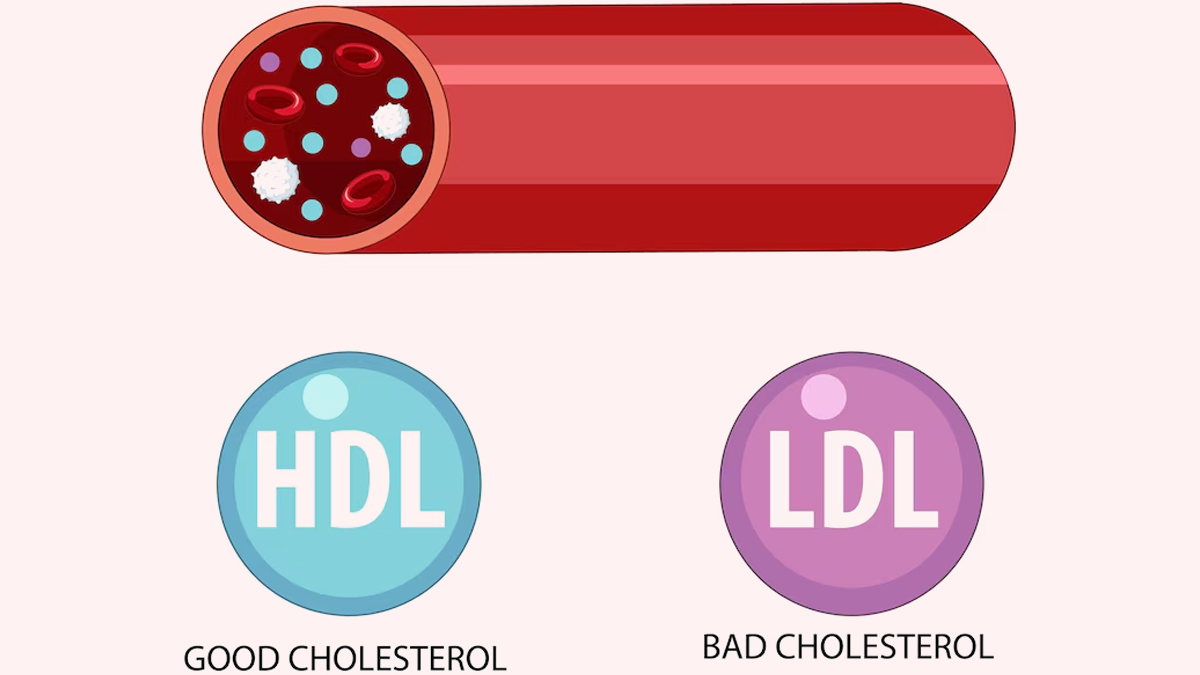 Cholesterol