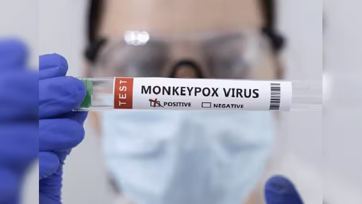 Mpox Virus