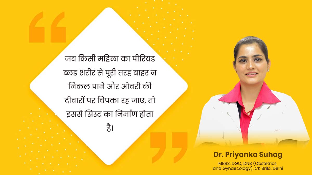 Chocolate-Cyst-inside