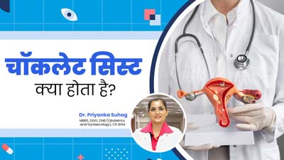 पीरियड्स में तेज दर्द हो सकता है चॉकलेट सिस्ट का संकेत, जानें ओवरी की इस समस्या के कारण और इलाज