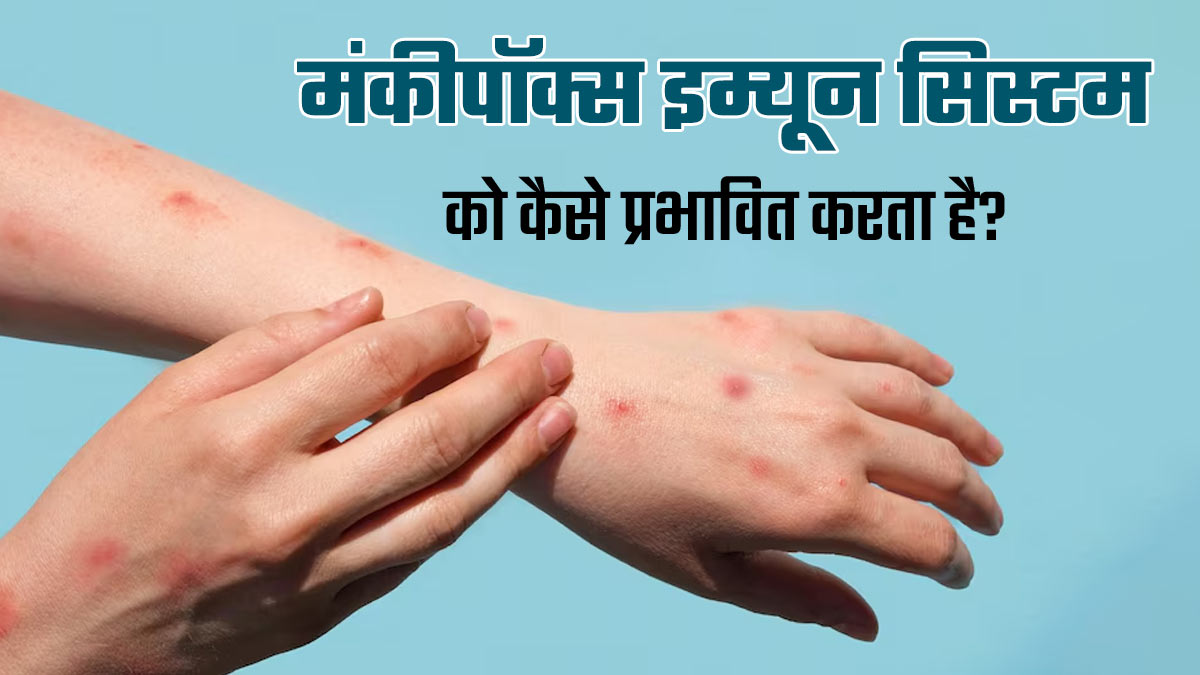 तेजी से बढ़ रहे मंकीपॉक्स (Mpox) के मामले, जानें यह इम्यून सिस्टम को कैसे करता है प्रभावित?