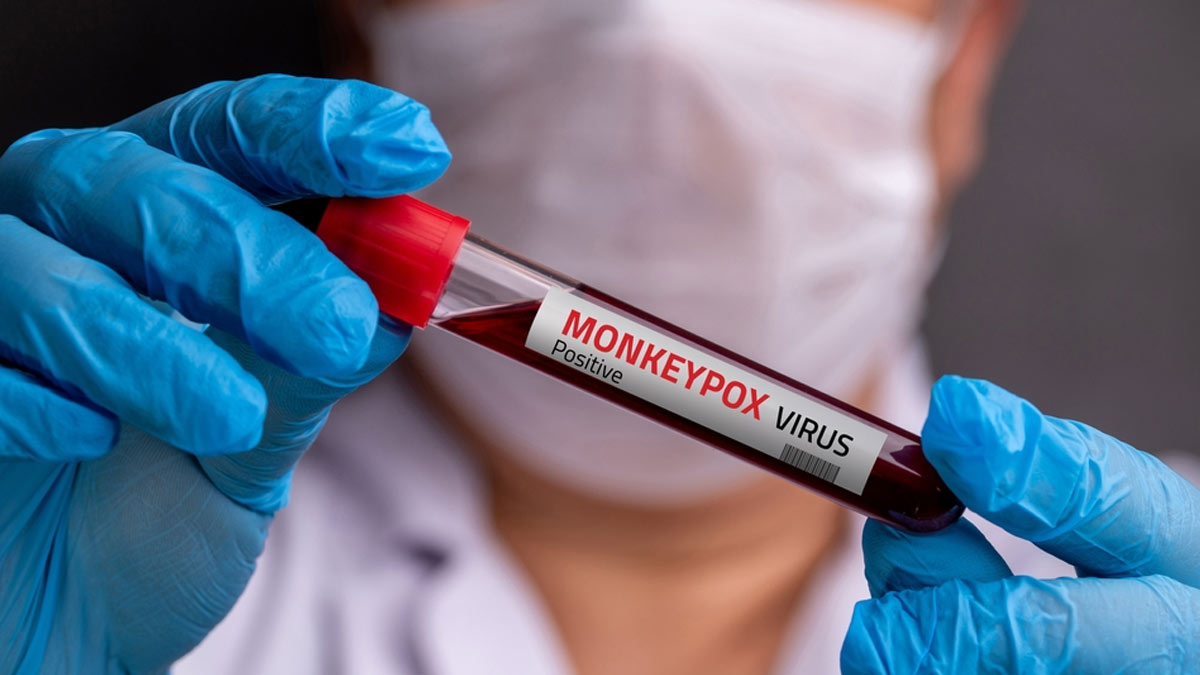 Suspected Mpox Infected Patient Admitted To AIIMS Delhi, Shifted To AB-7 Ward