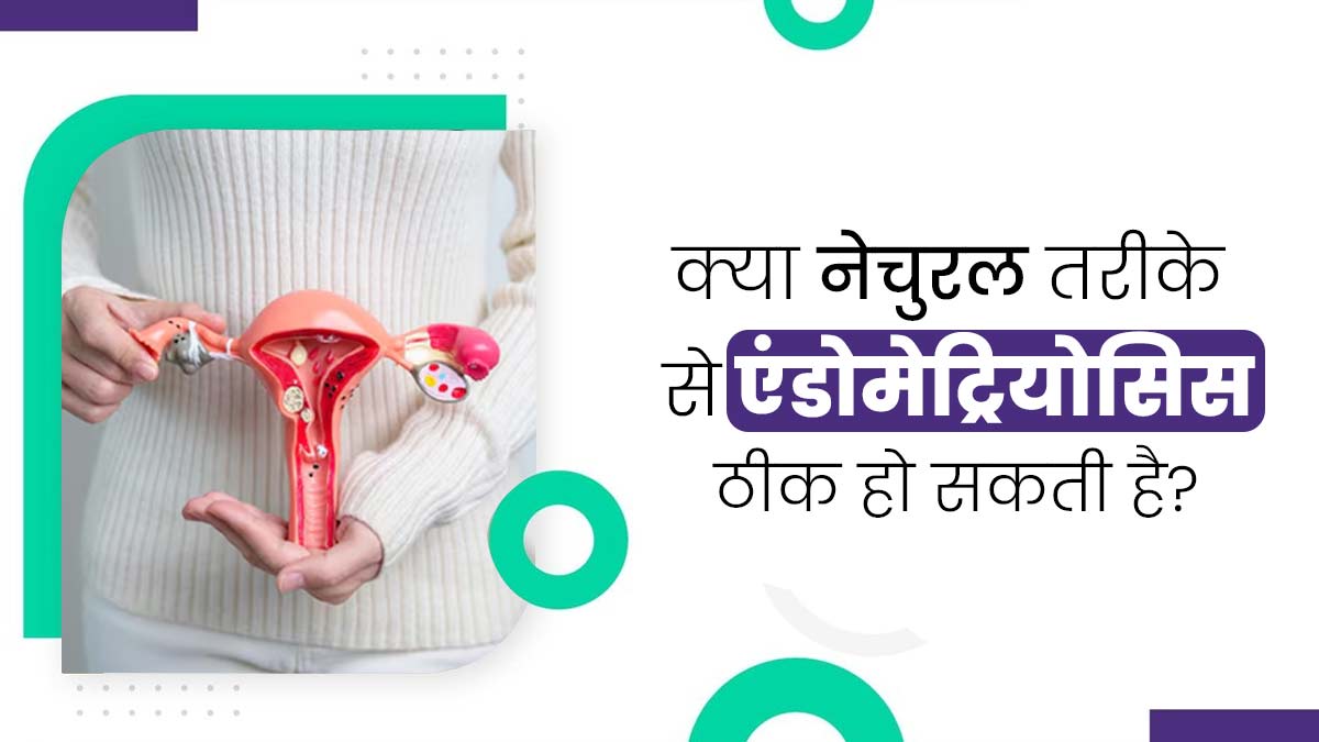 क्या एंडोमेट्रियोसिस (यूट्रस की एक समस्या) का नेचुरल तरीके से इलाज संभव है? एक्सपर्ट से जानें