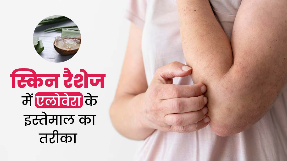 स्किन रैशेज होने पर इन 5 तरीकों से करें एलोवेरा का इस्तेमाल, मिलेगा आराम