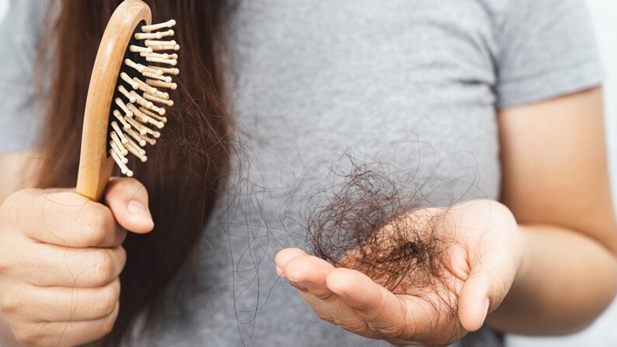 hair-loss