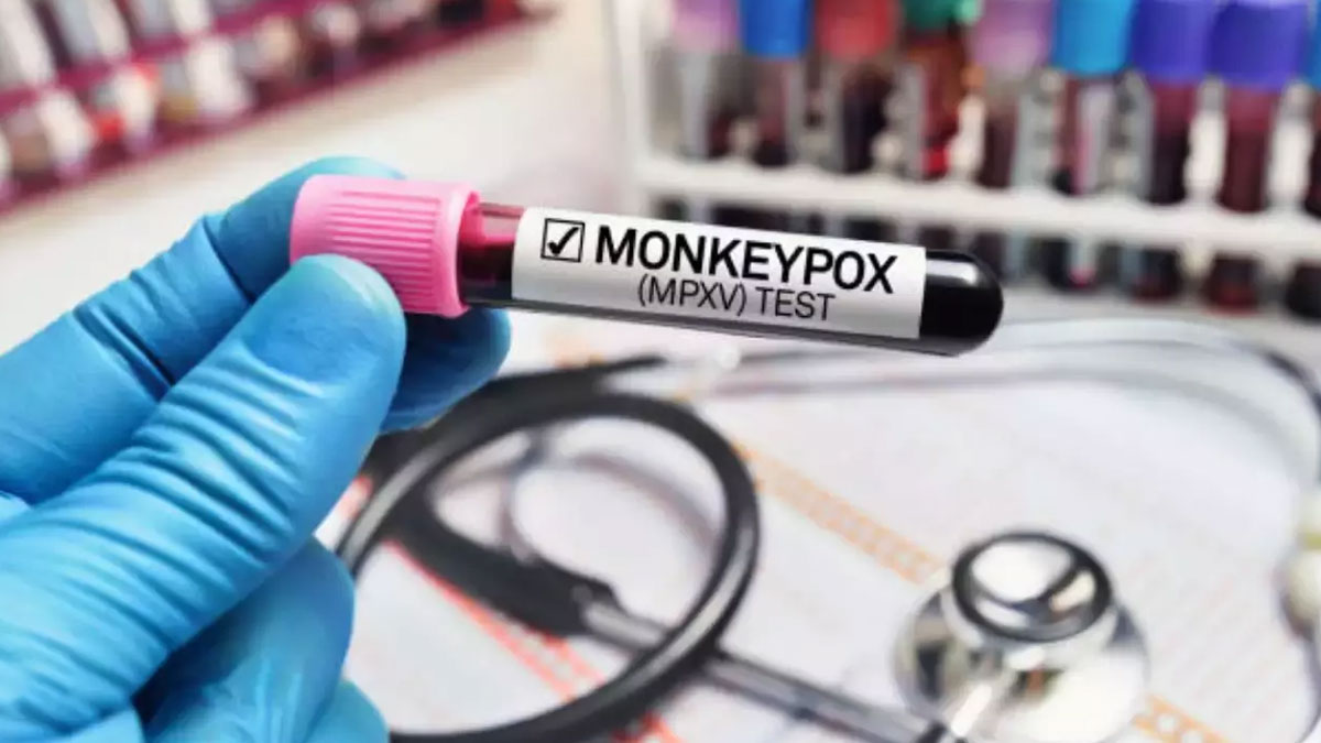 Drug Regulator Approves India's Indigenous RT-PCR Kit For Mpox | OnlyMyHealth