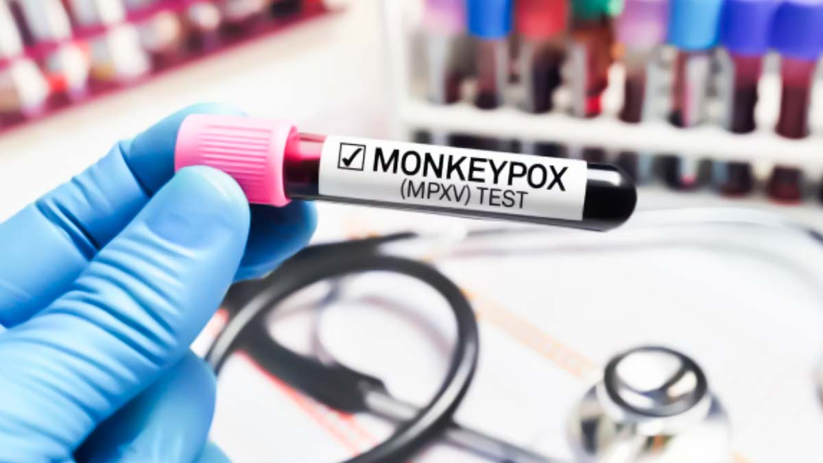 Mpox Updates: लगातार कहर बरपा रहा एमपॉक्स, भारत में भी तेज हुईं तैयारियां, जानें इससे जुड़े सारे अपडेट्स 