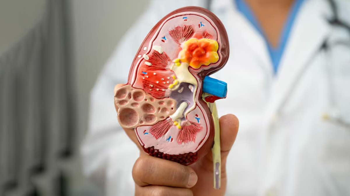 renal sinus disorder in hindi 