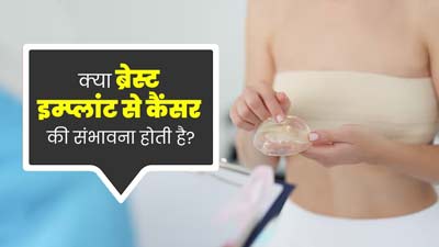 क्या ब्रेस्ट इम्प्लांट करने से कैंसर का जोखिम बढ़ता है? डॉक्टर से जानें 