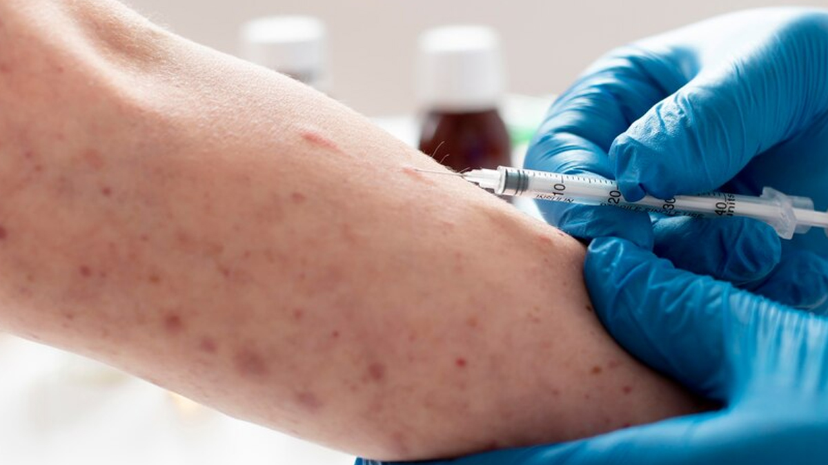 Can Mpox (Monkeypox) Be Transmitted From Mother To Fetus In Hindi