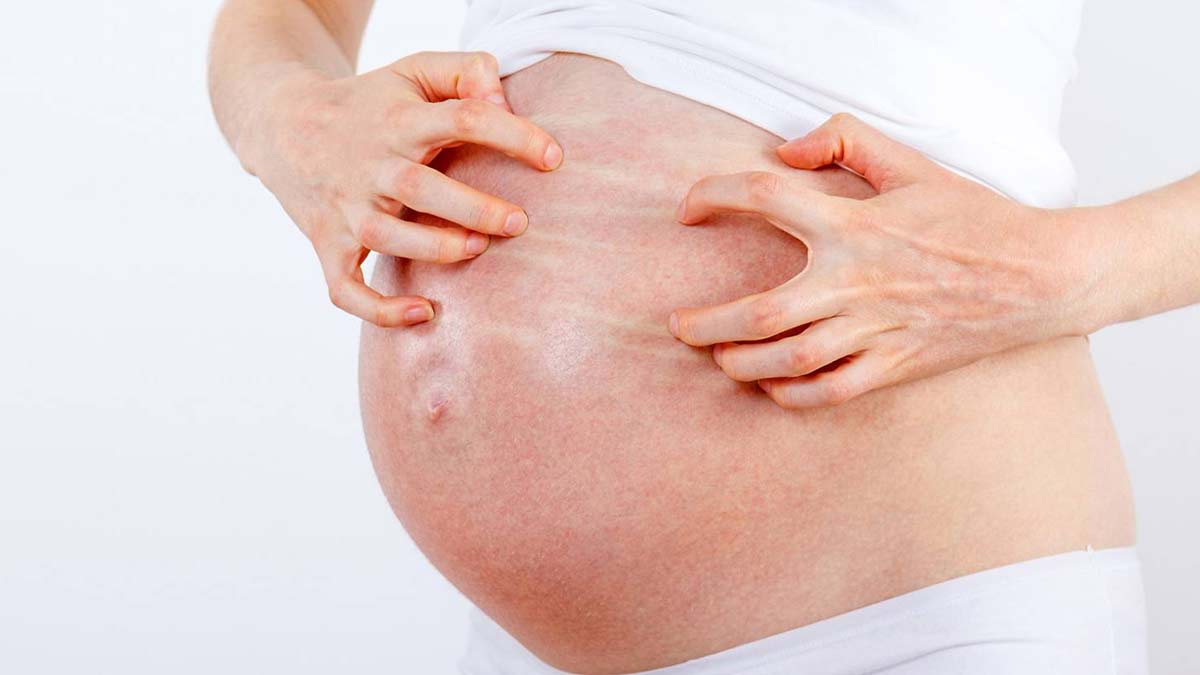 प्रेग्नेंसी में बैली के आसपास हो जाए रैशेज, तो राहत के लिए अपनाएं ये 5 घरेलू उपाय 