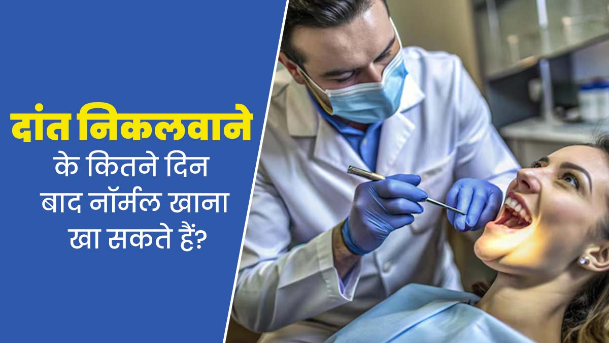 Tooth Extraction: दांत निकलवाने के कितने दिन बाद नॉर्मल खाना खा सकते हैं? जानें एक्सपर्ट से