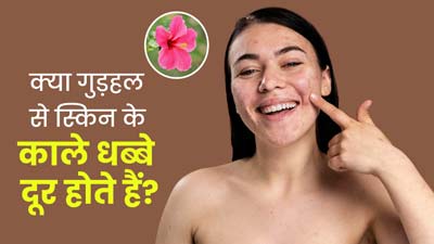 क्या गुड़हल के फूल त्वचा के काले दाग-धब्बे मिटाने में असरदार होते हैं? जानें इस्तेमाल का तरीके 