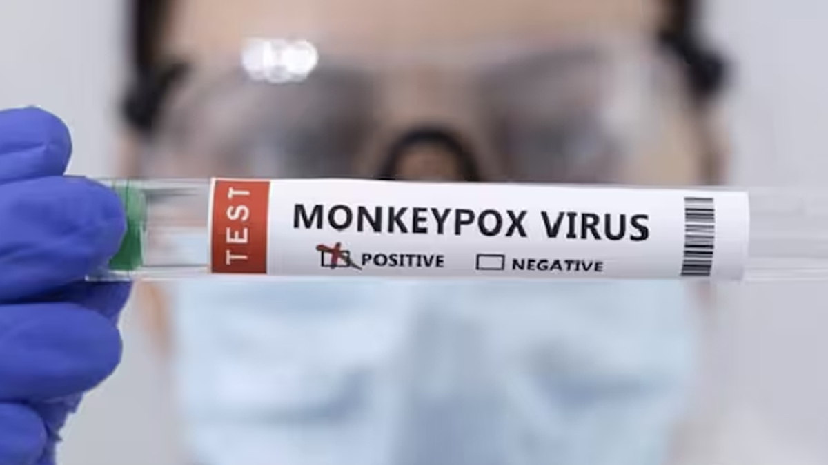 mpox