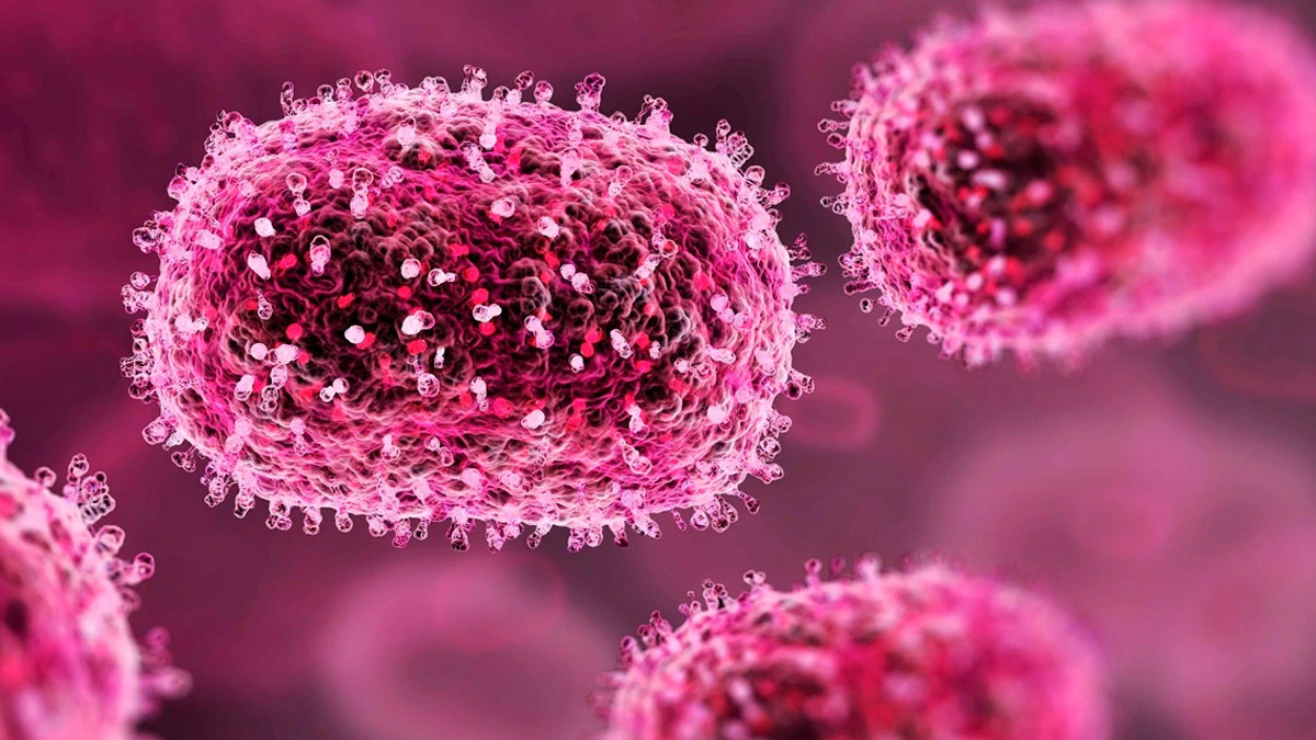 smallpox