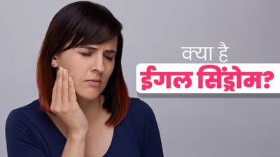 Eagle Syndrome क्या है? जानें इस दुर्लभ विकार के लक्षण और कारण