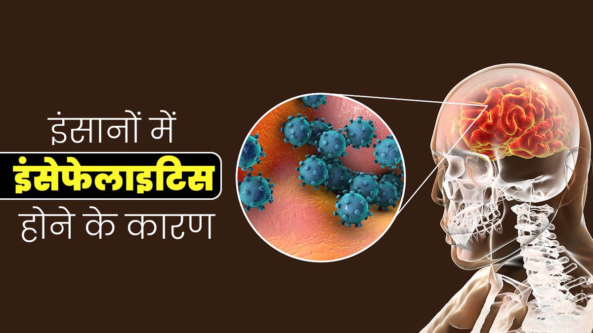 असम में बढ़ा रहा इंसेफेलाइटिस (मस्तिष्क में सूजन) का कहर, जानें शरीर में कैसे प्रवेश करती है यह बीमारी? 