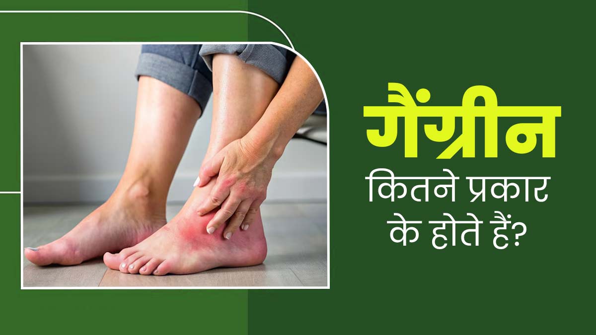 सूजन और मवाद से भरे दाने हो सकते हैं गैंग्रीन के संकेत, जानें इस गंभीर रोग के प्रकार