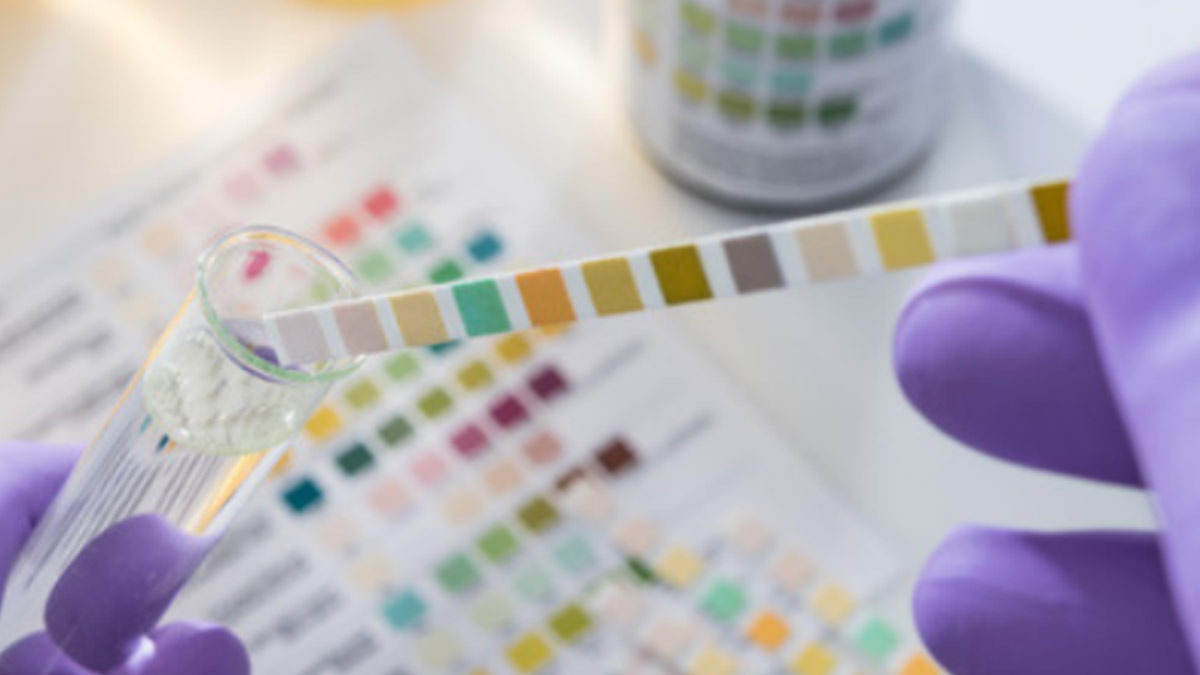 How To Pass A Drug Test- Proven Methods And Tips For Everyone