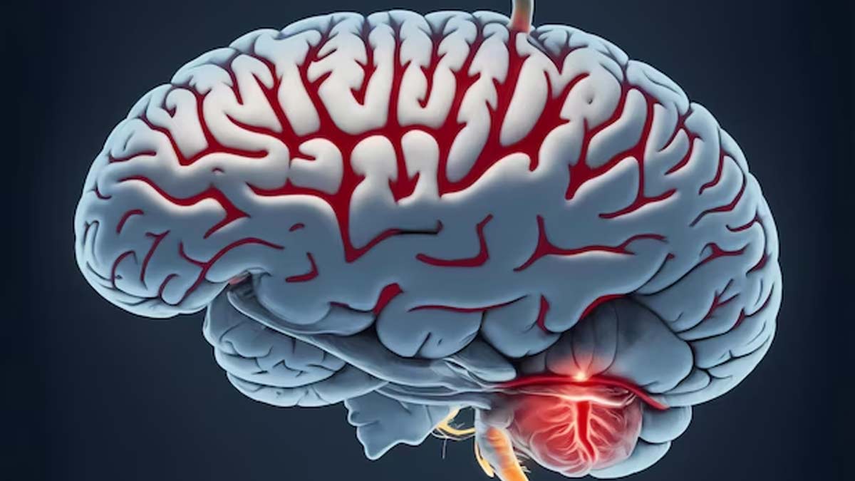 encephalitis types