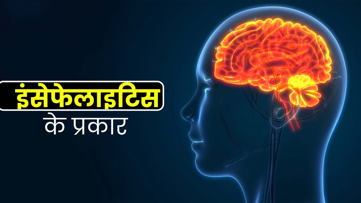 इंसेफेलाइटिस (दिमागी सूजन) कितने प्रकार का होता है? जानें इनके लक्षण और गंभीरता
