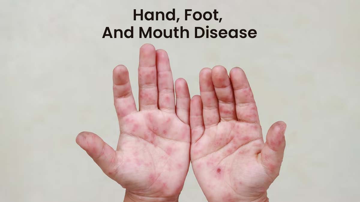 monkeypox and other skin conditions 