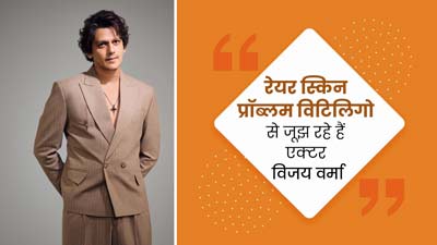 सफेद दाग की समस्या (विटिलिगो) से जूझ रहे हैं एक्टर विजय वर्मा, जानें इस बीमारी का इलाज संभव है या नहीं?