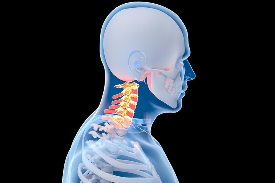 Cervical: Effective Ways To Reduce The Neck Pain