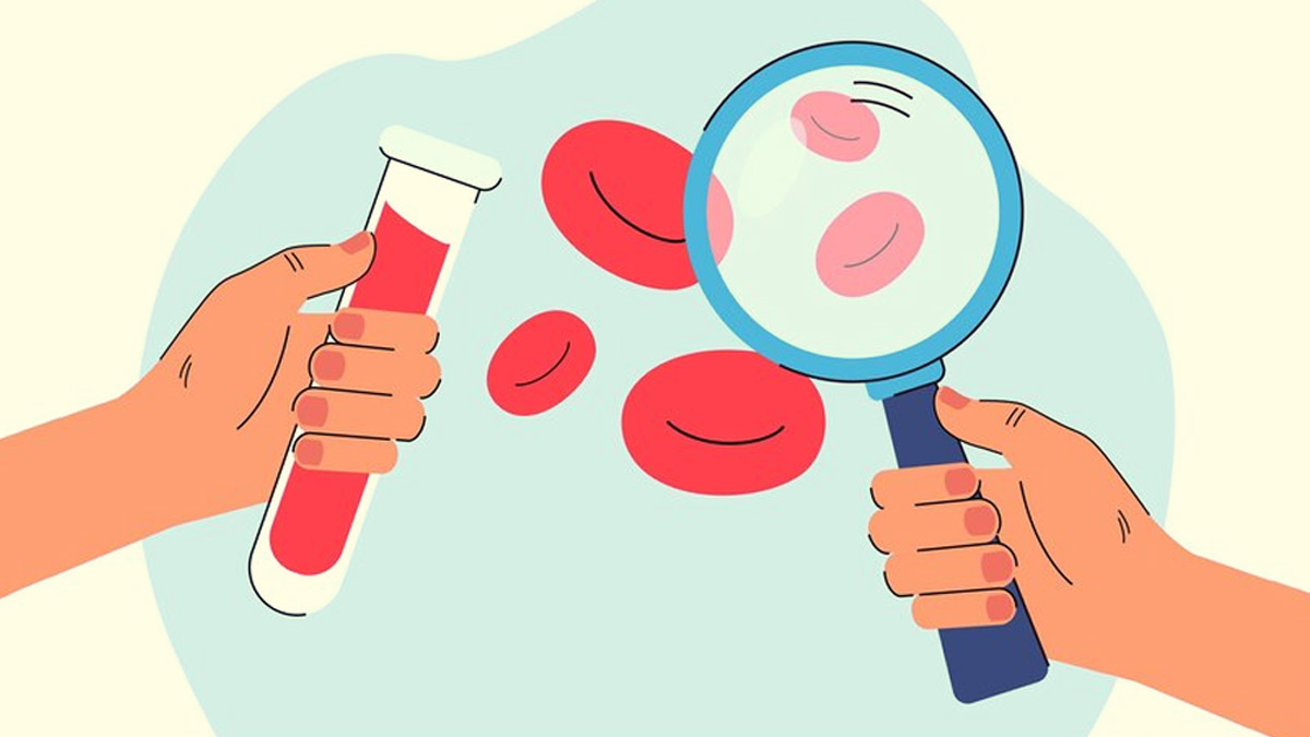 Cleaning Your Blood: Expert Lists Healthy Ways to Purify Your Blood
