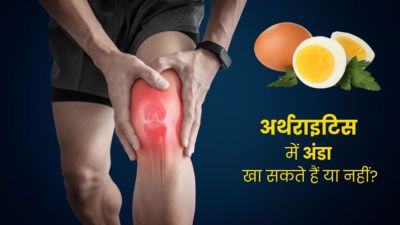 अर्थराइटिस में अंडा खा सकते हैं या नहीं? जानें डाइटिशियन से