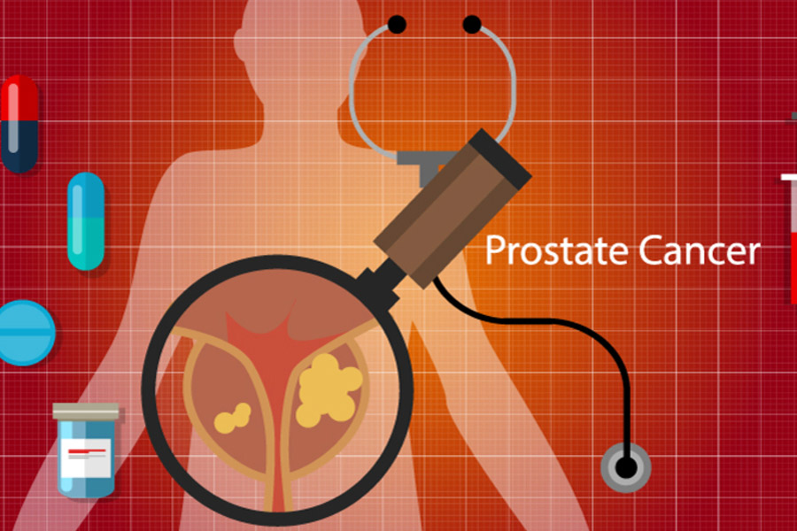 prostate-cancer