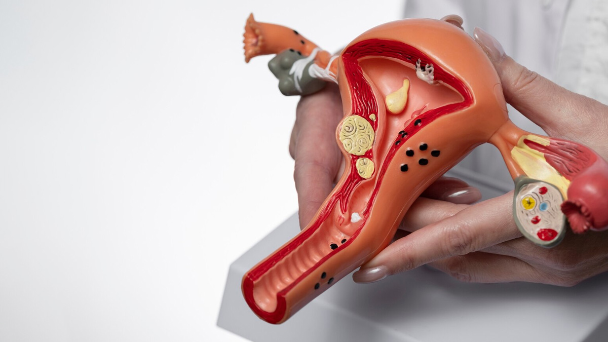 Can Women With PCOS Do Heavy Workouts In Hindi