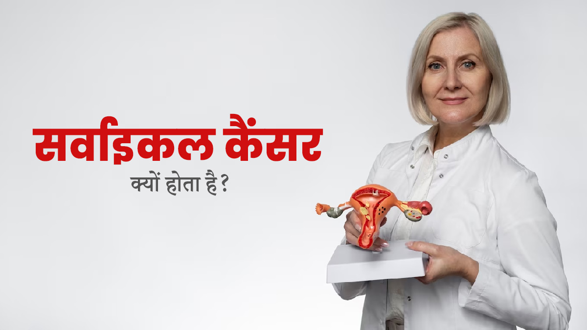 World Cancer Day 2024: सर्वाइकल कैंसर क्यों होता है? जानें इसके कारण