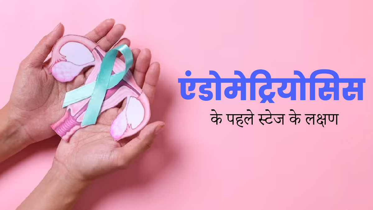 Endometriosis Stage 1: एंडोमेट्रियोसिस के पहले स्टेज में नजर आते हैं ये लक्षण, न करें अनदेखी