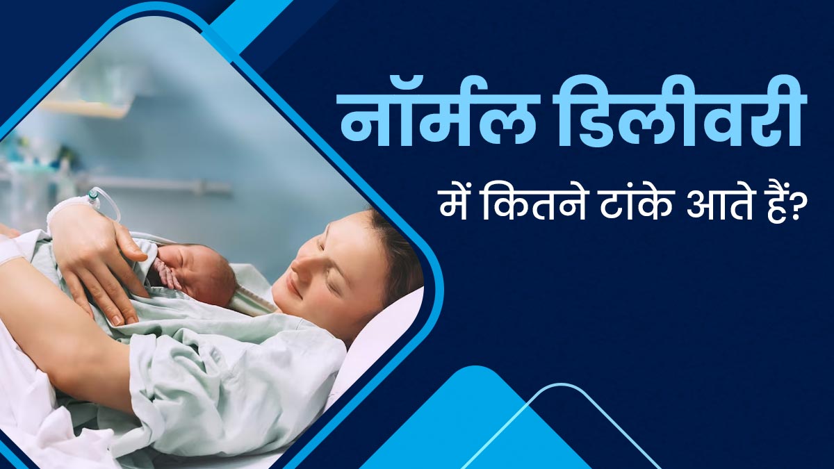 नॉर्मल डिलीवरी में कितने टांके आते हैं? डॉक्टर से जानिए इसके बारे में