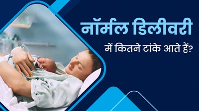 नॉर्मल डिलीवरी में कितने टांके आते हैं? डॉक्टर से जानिए इसके बारे में