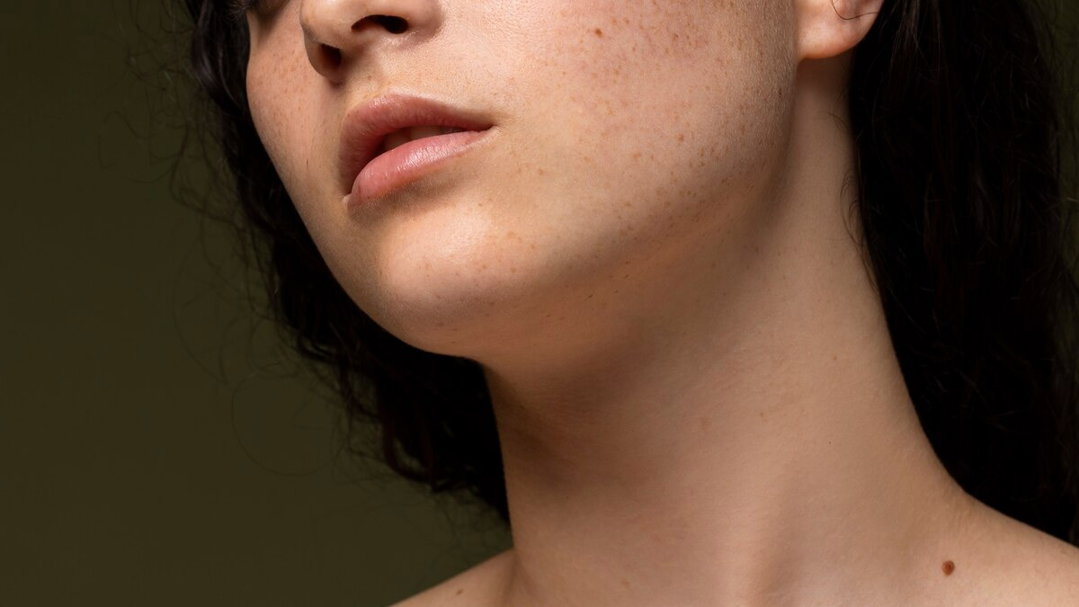 neck hyperpigmentation