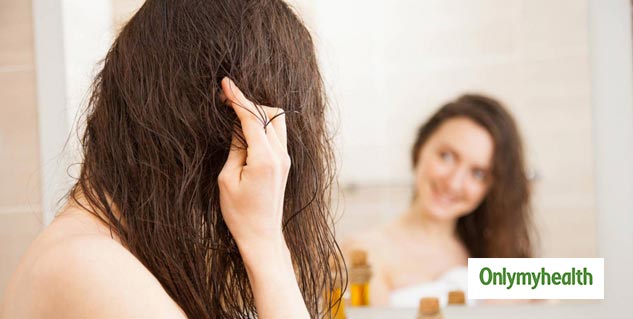 Should You Oil Your Hair Covered In Dandruff Tips To Deal With It