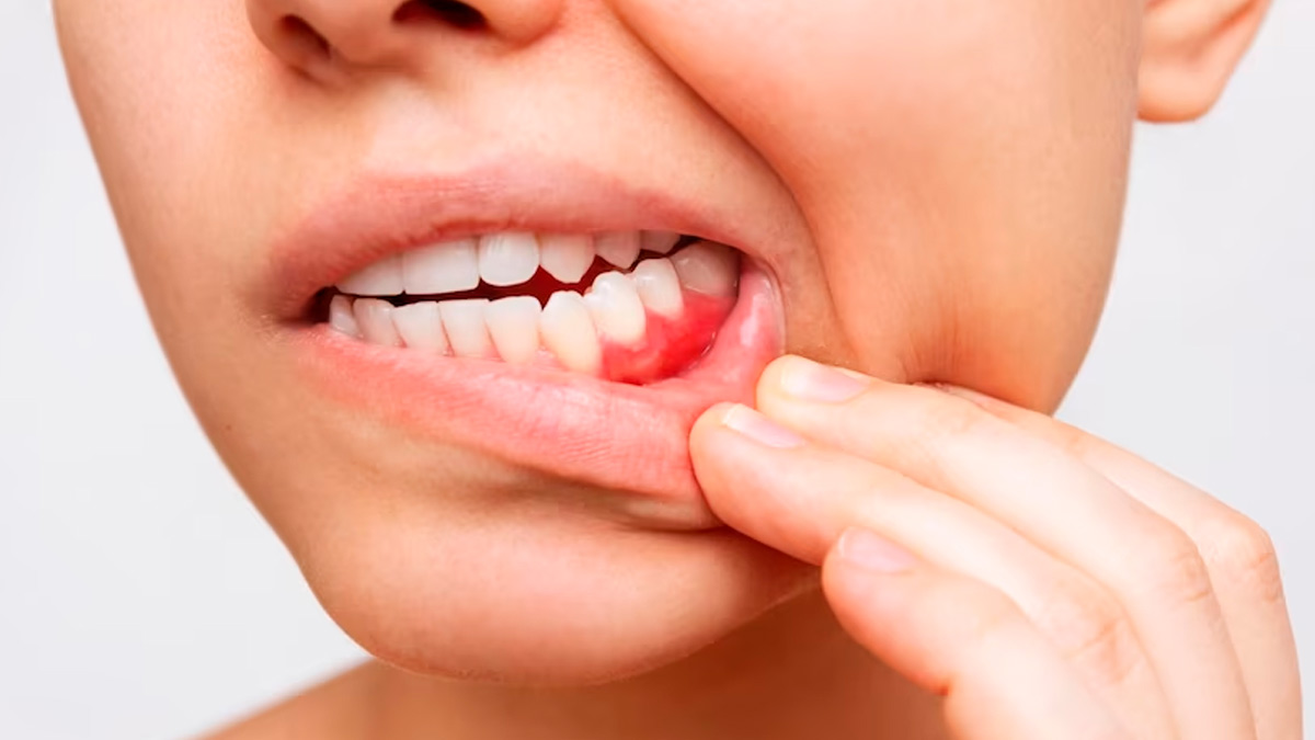 National Toothache Day 2024 Tips for Everyday Dental Health