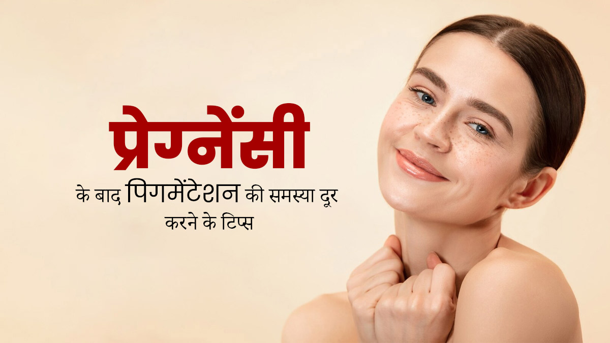 प्रेग्नेंसी के बाद चेहरे के काले धब्बों से चाहिए छुटकारा, तो इन घरेलू उपायों को करें ट्राई 