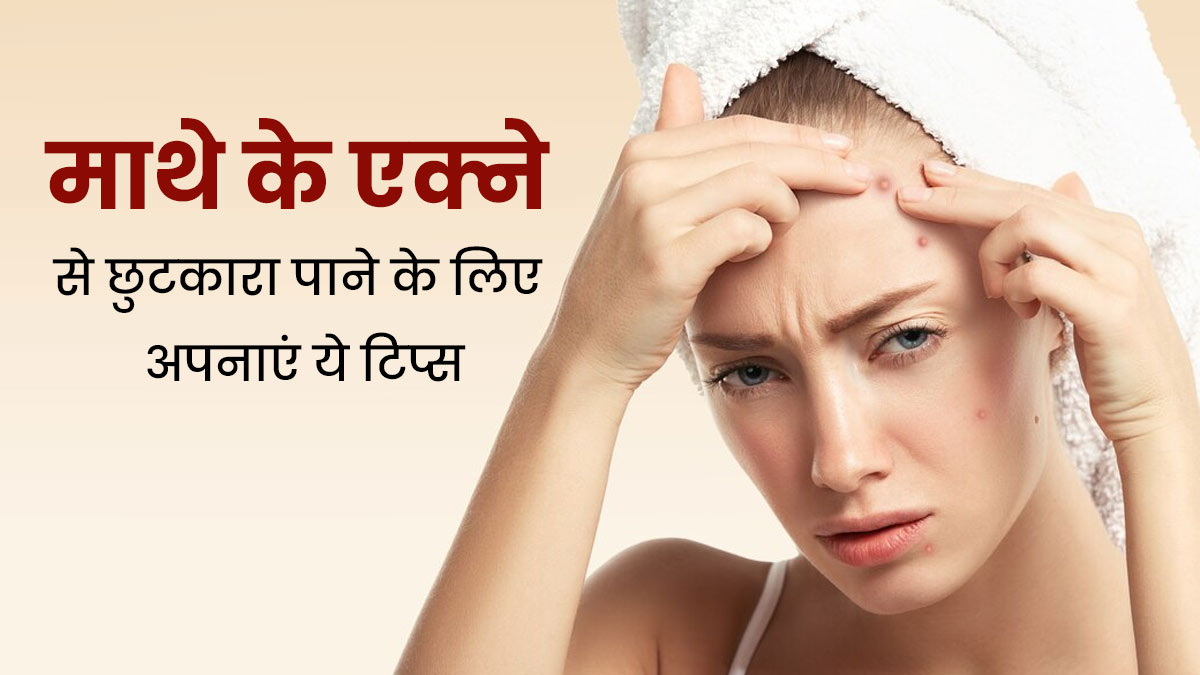 माथे के एक्ने से छुटकारा पाने के लिए अपनाएं ये खास टिप्स, जल्द दिखेगा असर
