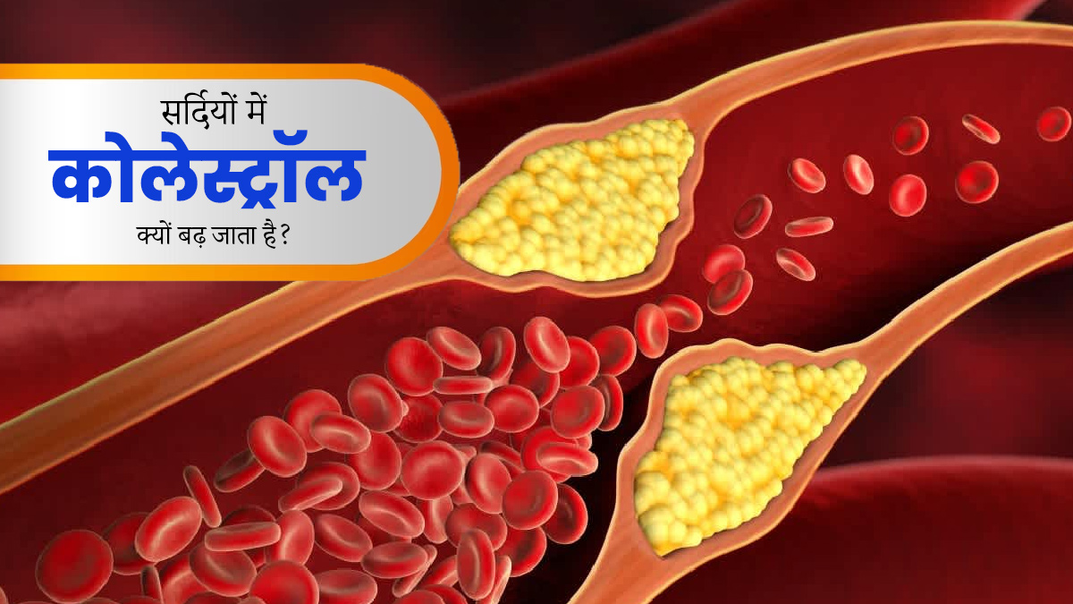 सर्दियों में कोलेस्ट्रॉल क्यों बढ़ जाता है? जानें इसे कैसे करें कंट्रोल