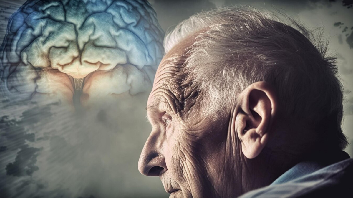 Are You At Risk Of Alzheimer's If A Family Member Has It? Neurologist Sheds Light
