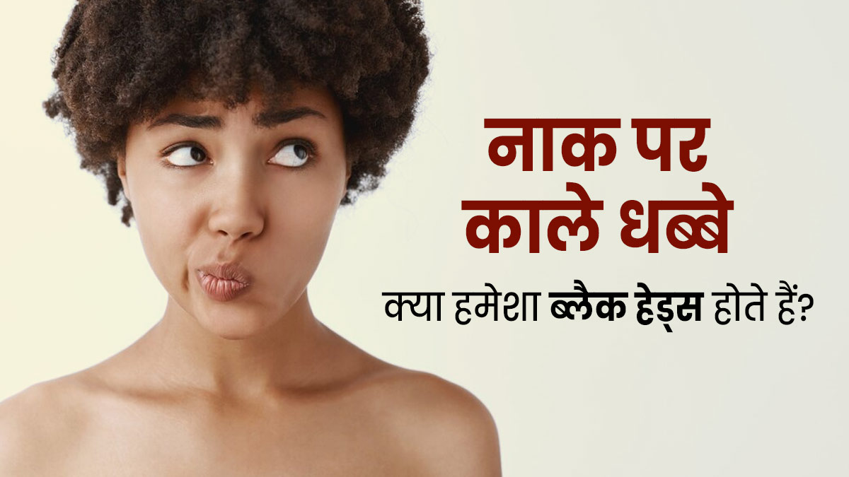 क्या नाक पर हो रहे काले धब्बे सिर्फ ब्लैकहेड्स होते हैं? जानें इस बारे में 