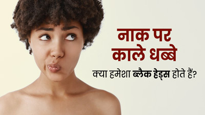 क्या नाक पर हो रहे काले धब्बे सिर्फ ब्लैकहेड्स होते हैं? जानें इस बारे में 