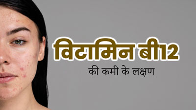 शरीर में विटामिन बी12 की कमी होने पर त्वचा और बालों में नजर आते हैं ये संकेत, जानें 