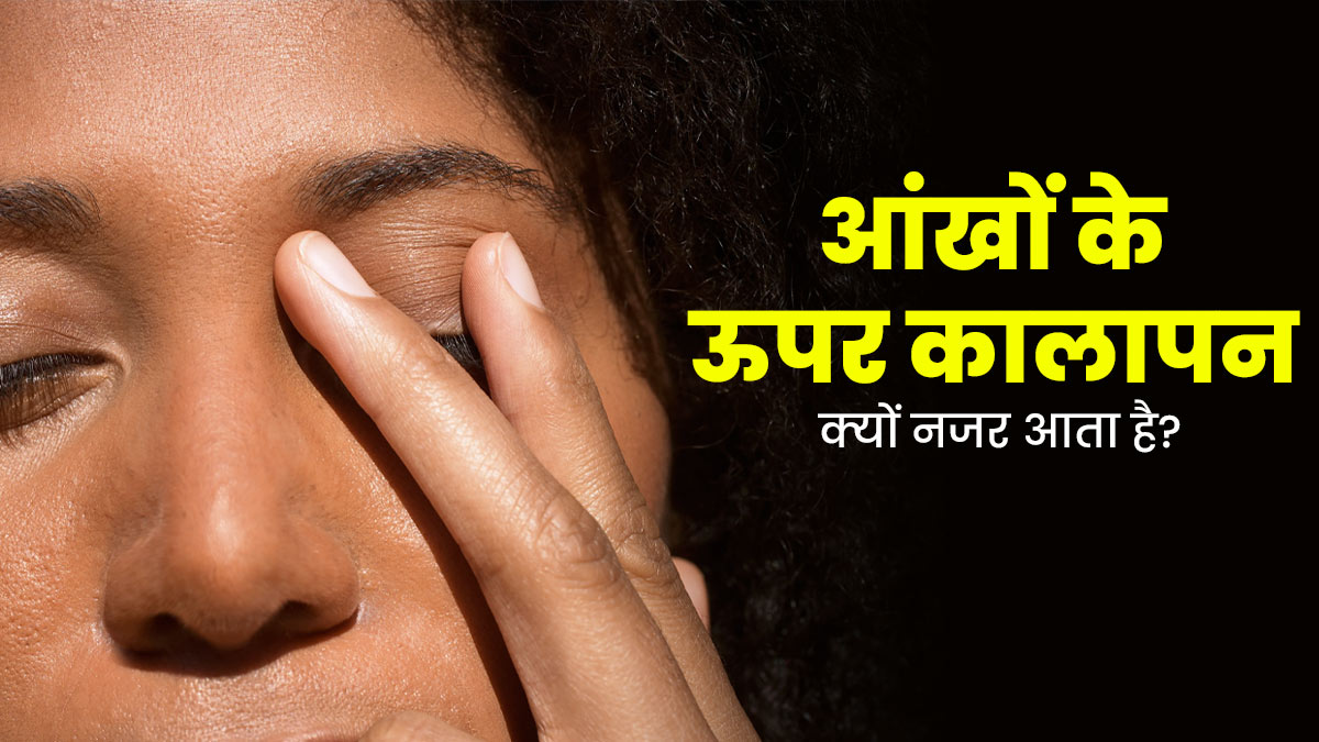 आंखों के ऊपर कालापन क्‍यों नजर आता है? जानें कारण और इसे दूर करने के घरेलू उपाय 