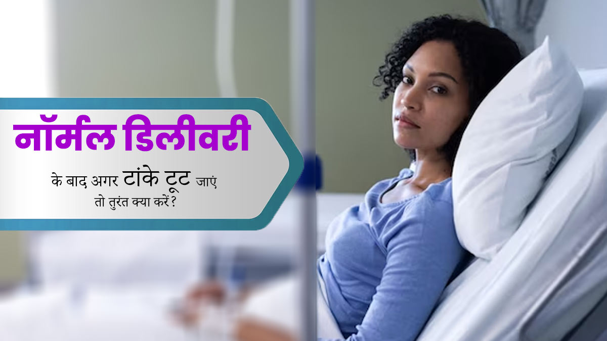 नॉर्मल डिलीवरी के टांके टूट जाए तो तुरंत करें ये काम, मिलेगा आराम
