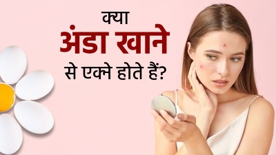 क्‍या अंडा खाने से एक्‍ने या मुंहासों की समस्या होती है? एक्‍सपर्ट से जानें 